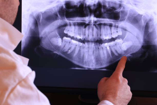 Best Weekend Emergency Dentist in Twin Lake, MI