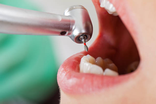 Best Emergency Dental Services for Seniors in Twin Lake, MI